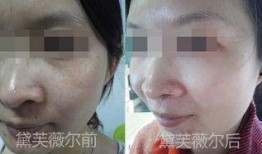 生活每日爆料之祛斑视频,揭秘生活小妙招，轻松告别斑点困扰